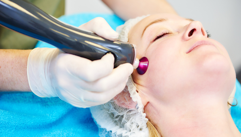 Young woman has changes made to her skin using a laser, e.g. removal of moles